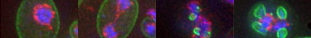 Photo showing the phases of meiosis taken with a microscope
