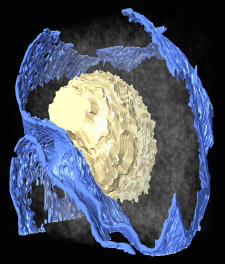 Breast Cancer Cell