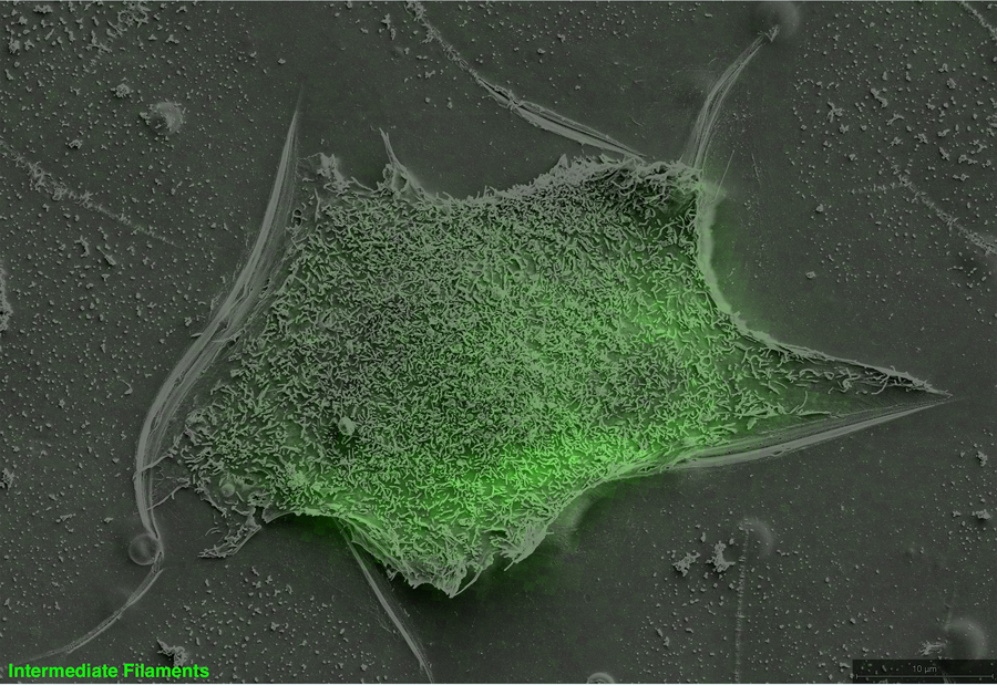 Breast Cancer Cell