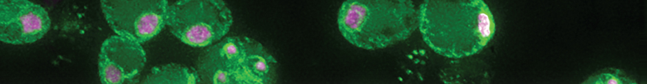 Brar lab meiosis research image