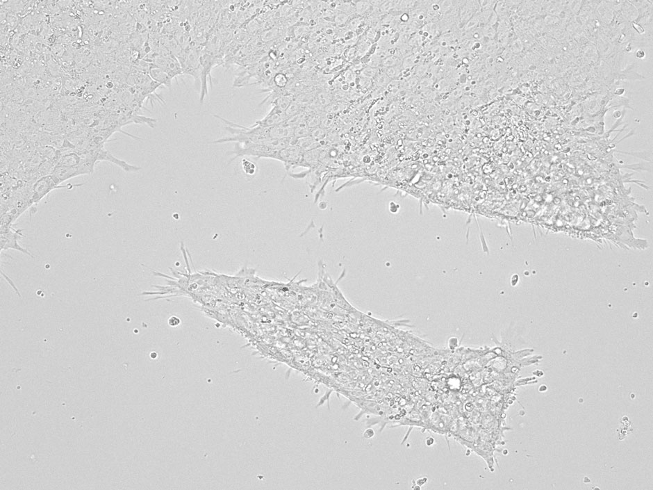 Human stem cells