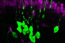Neurons (green) derived from a single stem cell in the olfactory epithelium of the nose. The magenta cells are support cells called sustentacular cells.