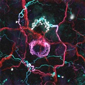  Magenta and white neurons 