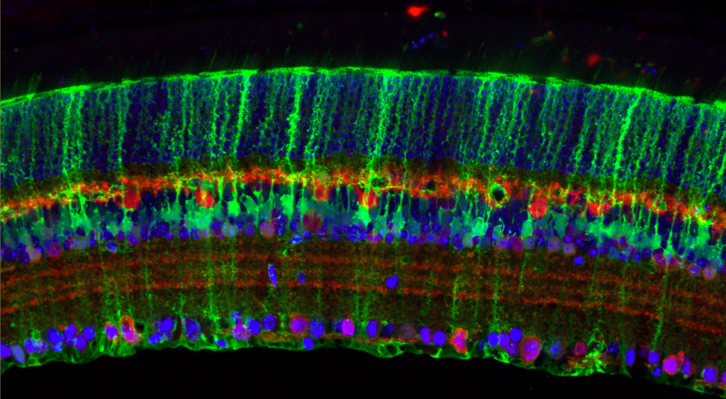 Histology image of a retina expressing GFP