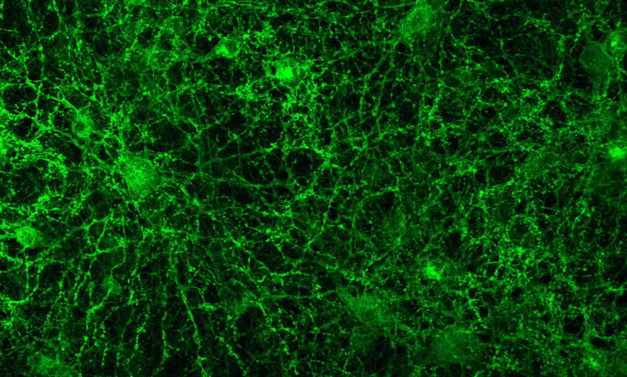 Histology image of a retina expressing GFP