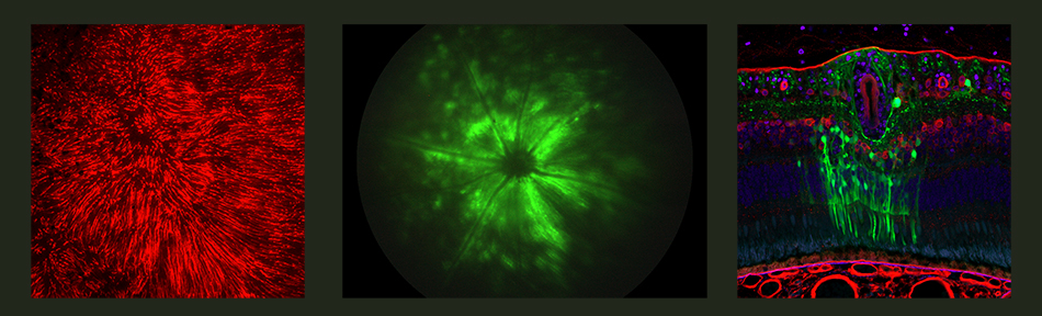 Histology image of a retina expressing GFP