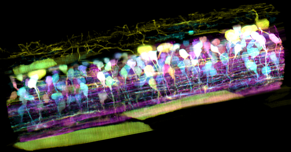 Zebrafish Neuron