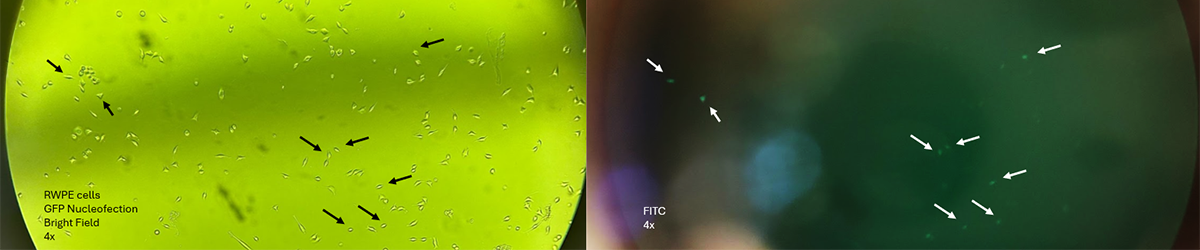 Nucleofection of RWPE cells (a prostate cell line) with GFP from our synthetic lethality module