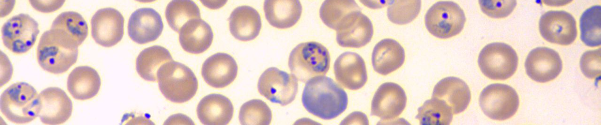 Rijo-Ferreira research Plasmodium parasites