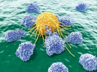 NK Cells, about 20 um wide, attack a cancer cell