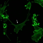 Oncogenically transformed fibroblasts